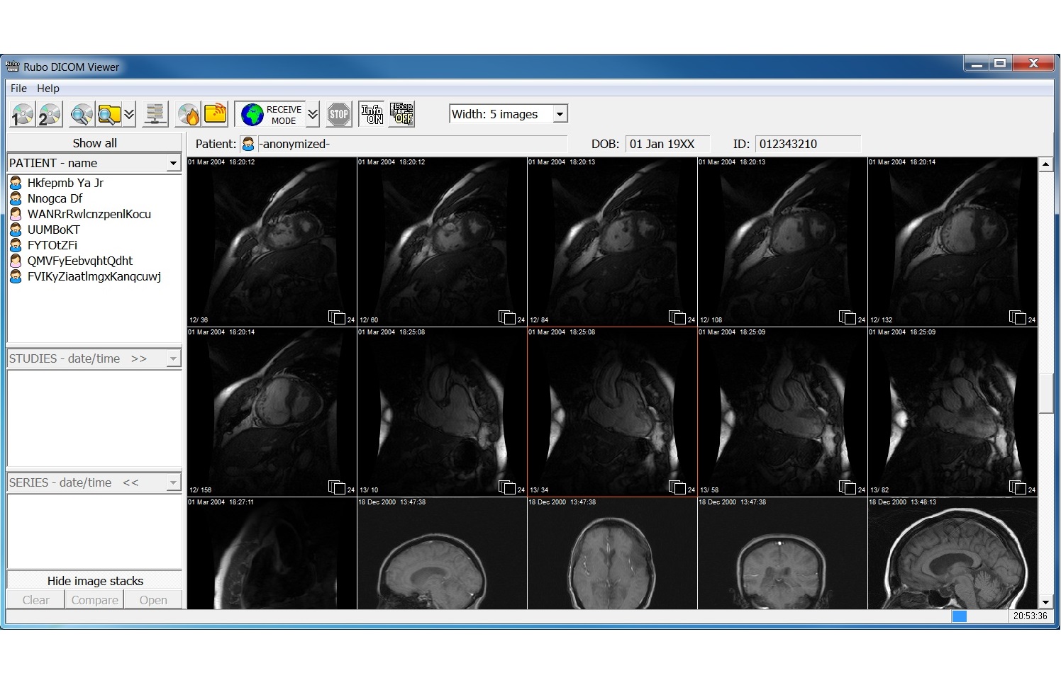 MRI reader online