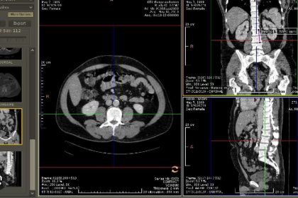 online DCM viewer